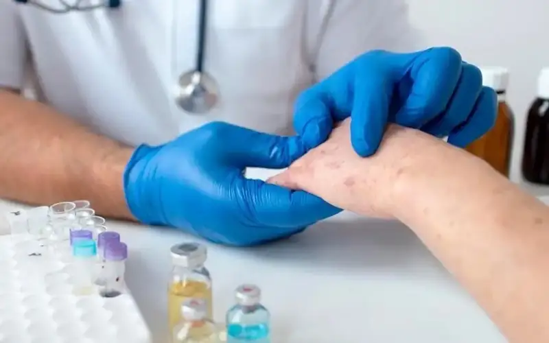 Nearly 2,800 measles cases recorded in Kazakhstan since start of 2025 