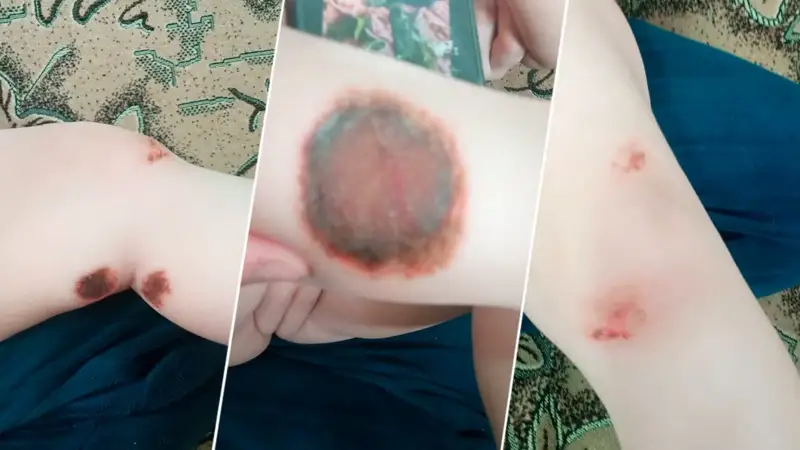 Двое младенцев получили ожоги чистящим средством в Павлодаре