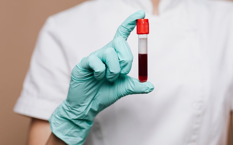 Blood test Blood test, healthcare, medicine