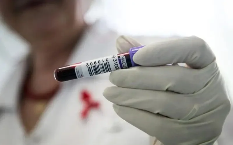 Өзбекстанда шетелдіктер мен мигранттарға ВИЧ-ке міндетті тестілеу енгізілмек