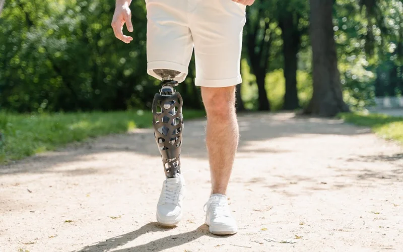 Жыл сайын қазақстандықтарға 70 мыңнан астам протездік-ортопедиялық өнім беріледі