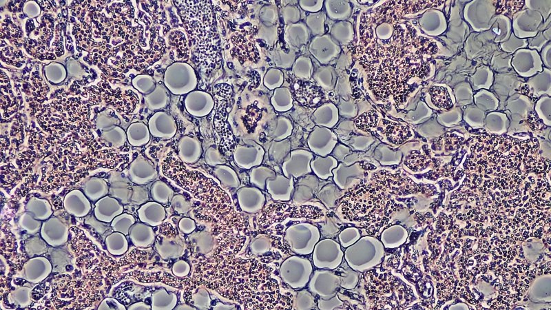 Zombie cells, stress, and the brain: The new science of growing old Zombie cells