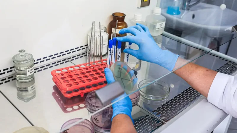 Cutaneous anthrax cases reported in Akmola region