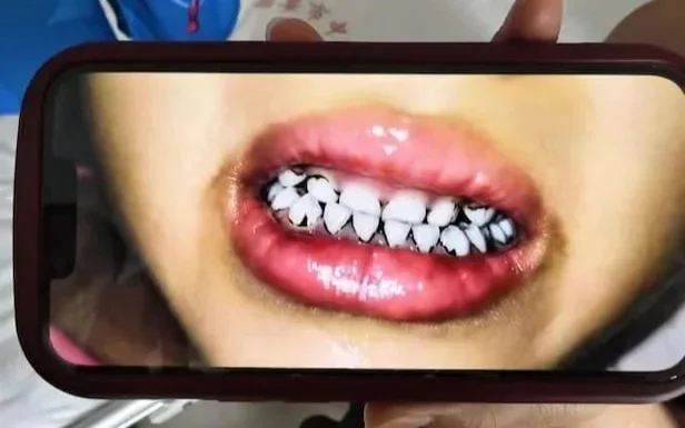 Более 70 детей отравились свинцом в Китае