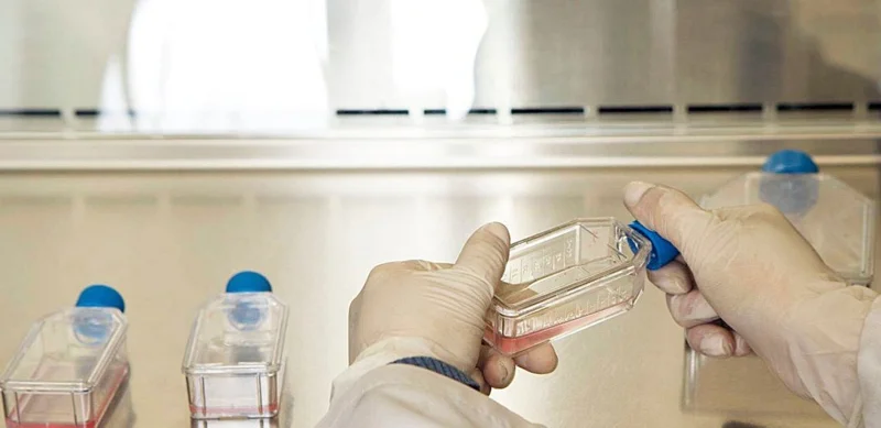 Казахстан признан лидером в ЦА по снижению смертности от неинфекционных заболеваний