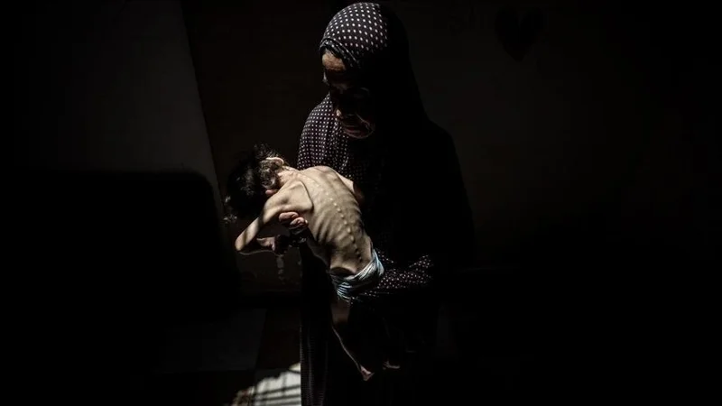 Gaza sektorynda ashtyqtan taǵy 5 adam qaza tapty