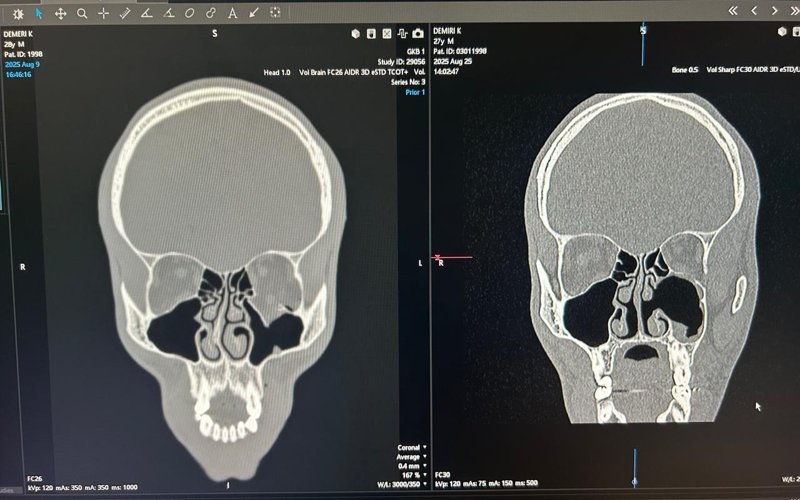 Врачи прооперировали французского боксера после травмы на ринге в Шымкенте Врачи прооперировали французского боксера после травмы на ринге в Шымкенте