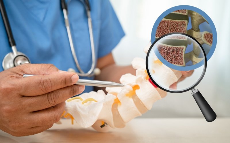 German scientists uncover key to stronger bones and potential osteoporosis therapy Bones