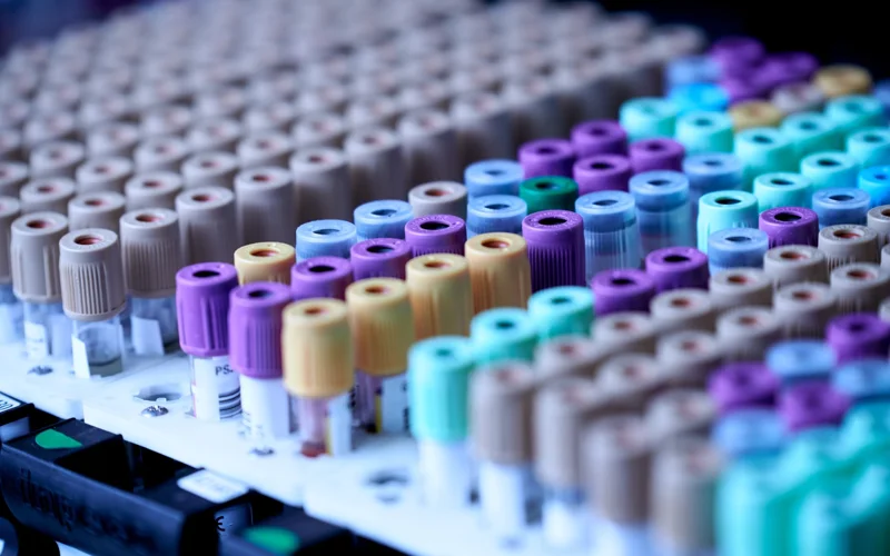 Blood test
