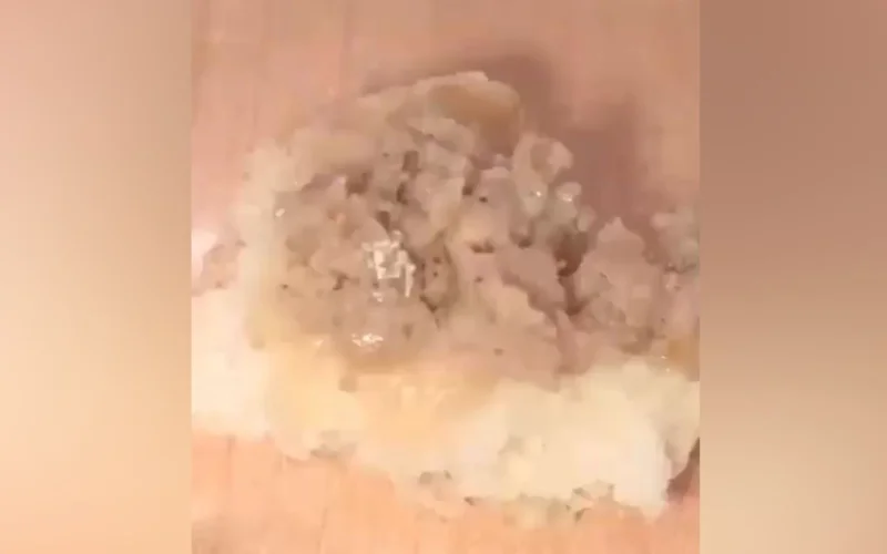 Живые личинки в школьной самсе: чем кормят детей в Жетысу?