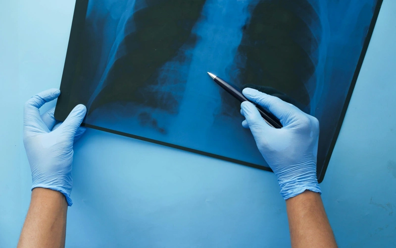 Более 250 человек обратились с травмами с наступлением гололеда в Акмолинской области