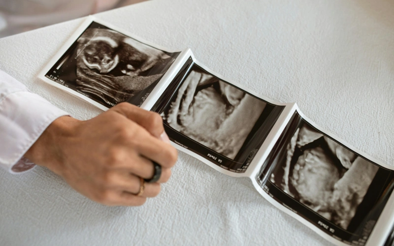 В Актау родилась девочка-богатырь весом более 6 килограммов