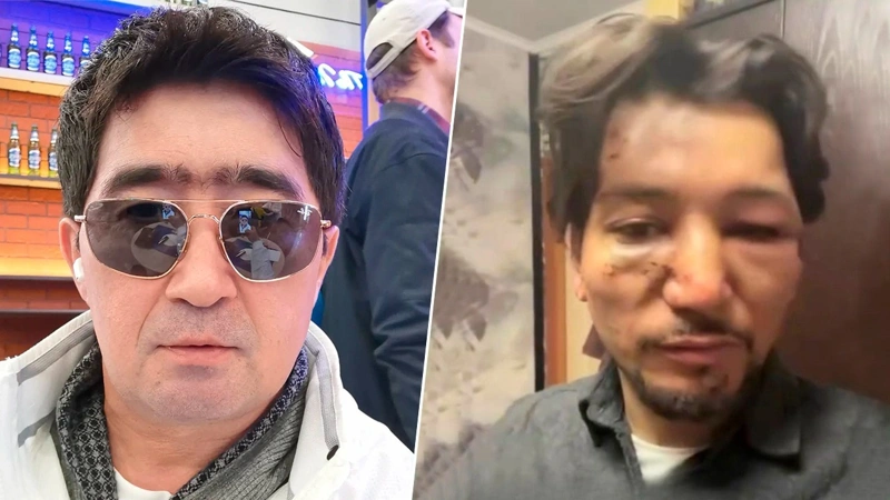 Известного казахстанского певца обвинили в избиении: возбуждено дело