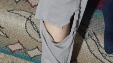 SQO-da jabaıy túlki adamǵa shapty SQO-da jabaıy túlki adamǵa shapty