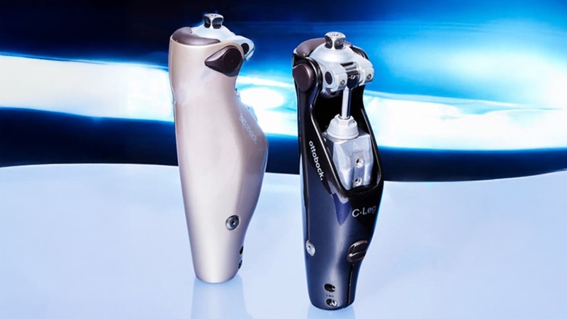 Как делают протезы в Казахстане протезы