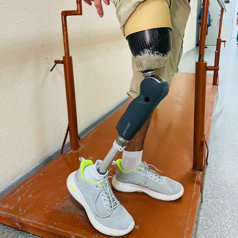 Как делают протезы в Казахстане протезы