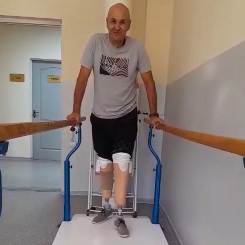 Как делают протезы в Казахстане протезы