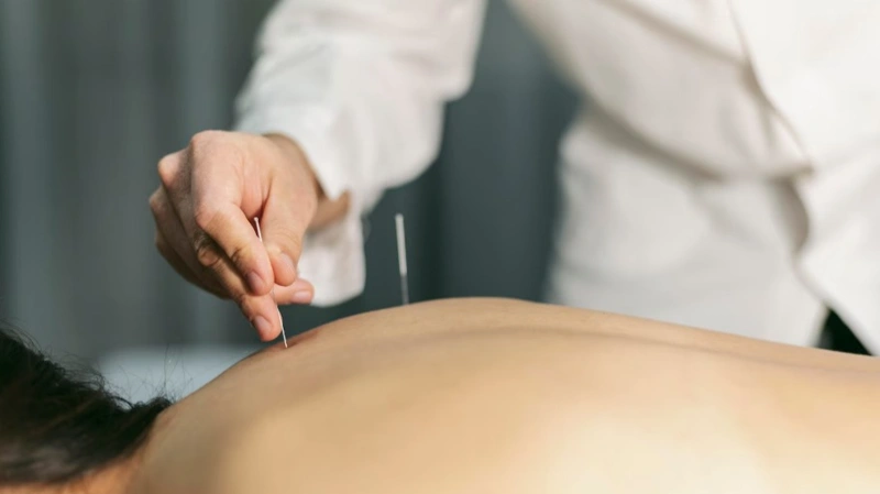 акупунктура, инемен емдеу