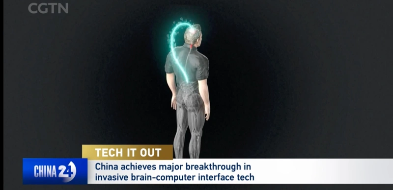 Brain implant, China, paralyzed patients, science