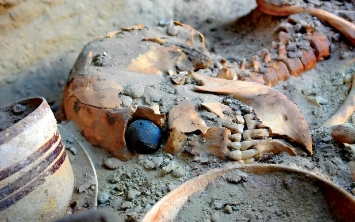 Әлемдегі алғашқы жасанды көз қайдан табылғанын білесіз бе?