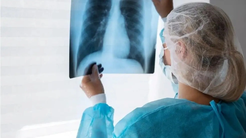 Tuberculosis cases down in Almaty