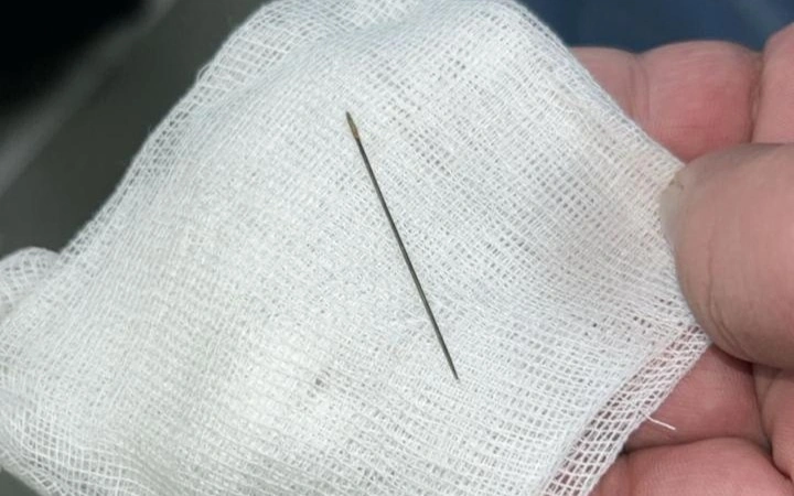 Иглу из брюшной полости 8-месячного младенца извлекли врачи в Туркестане