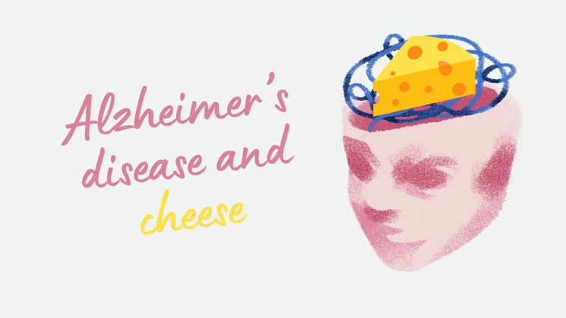 Cheese linked to lower Alzheimer’s risk in 25-year study