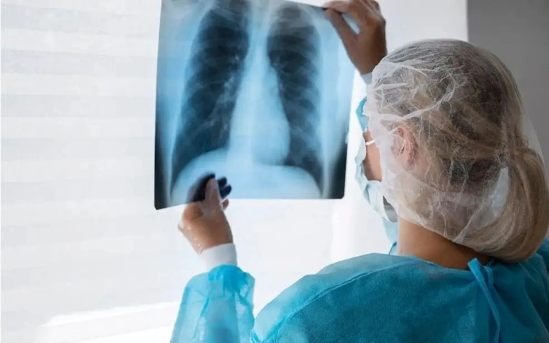Tuberculosis rates decline in Kazakhstan