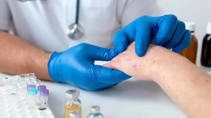 Measles cases up in Almaty