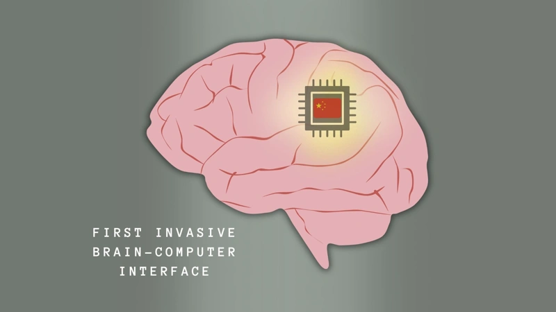 China greenlights first brain chip to restore movement