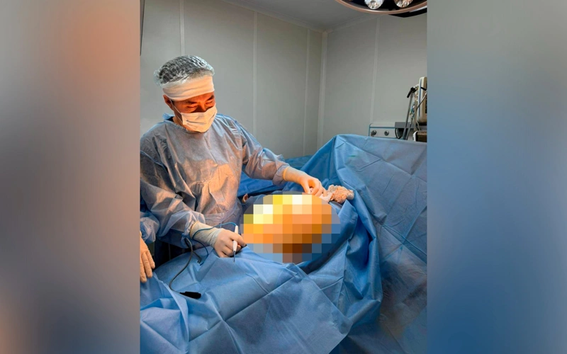 Алматинка лечила БАДами 25-килограммовую опухоль, скрывая свое состояние от родственников