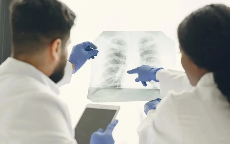 Kazakhstan sees over 13% decline in tuberculosis cases