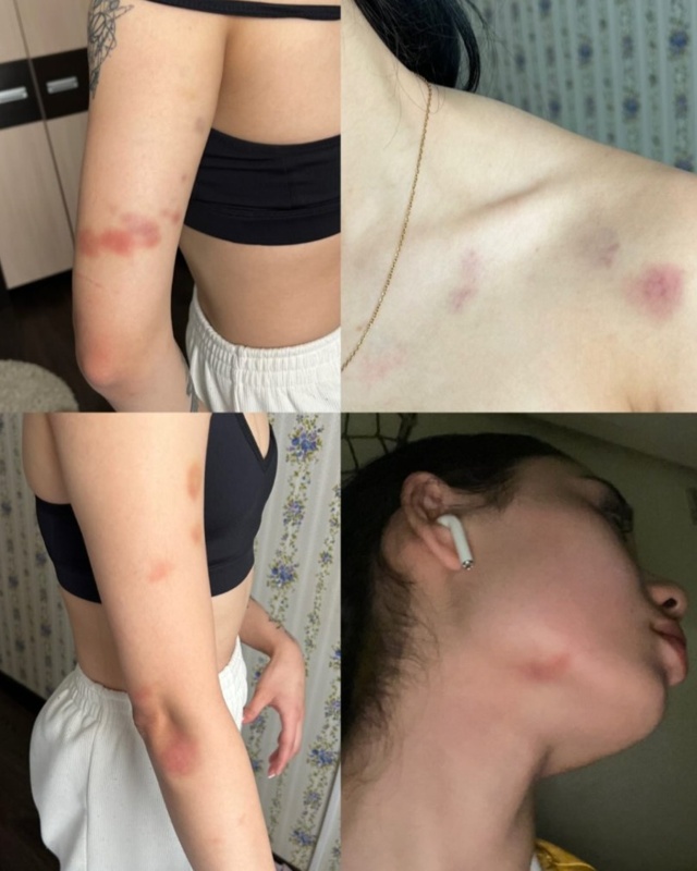 19-летняя девушка пожаловалась на избиение хоккеистом в Кокшетау