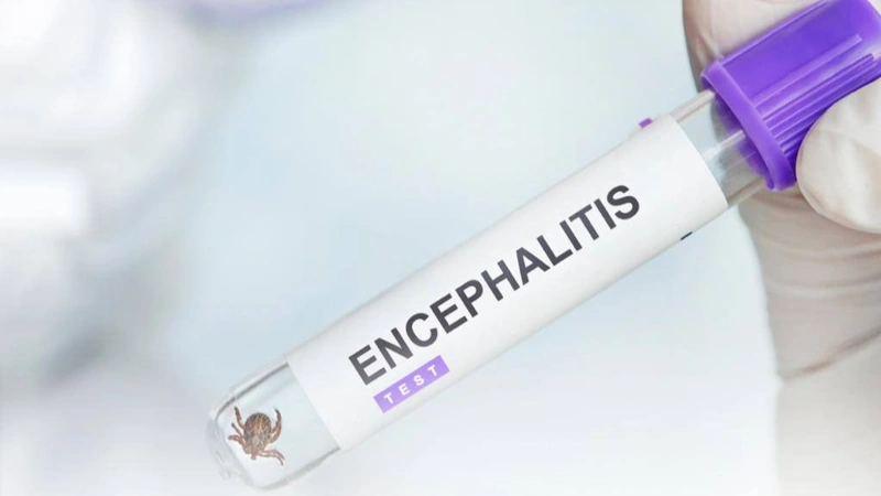 kene, entsefalıt
