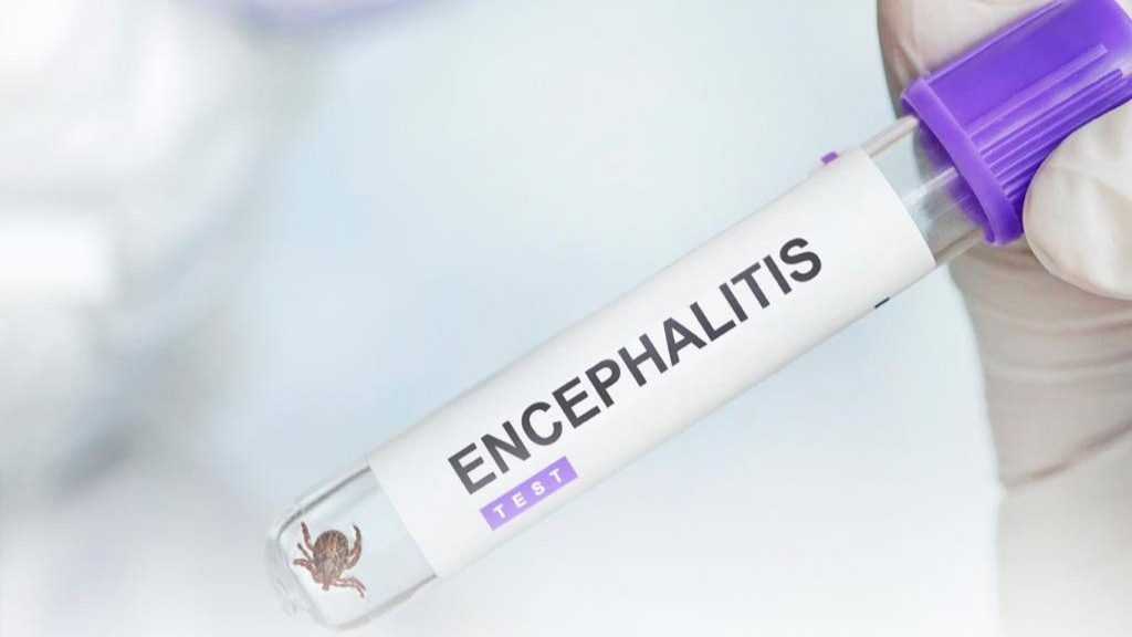 Кенеден қалай қорғануға болады — маман кеңесі