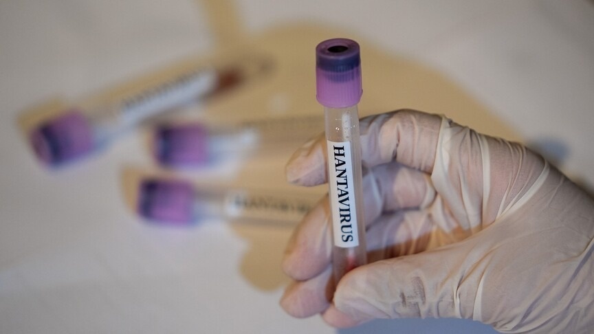 Venezuela confirms three hantavirus deaths, rules out human-to-human transmission