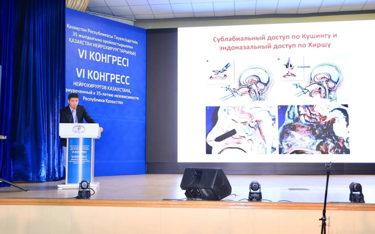 Елімізде жыл сайын 36 мың нейрохирургиялық операция жасалады