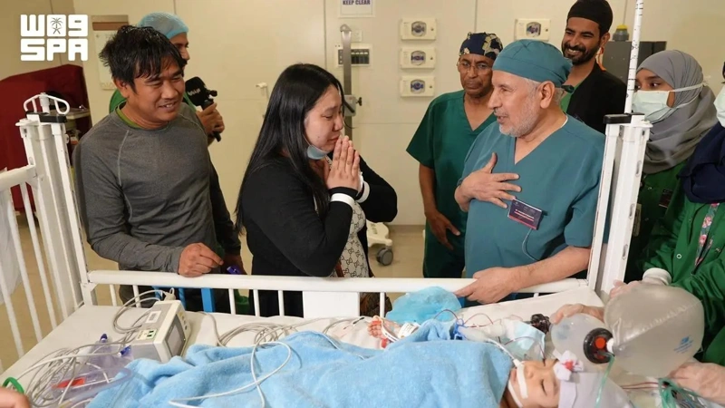 Filipino conjoined twins separated after six-hour surgery