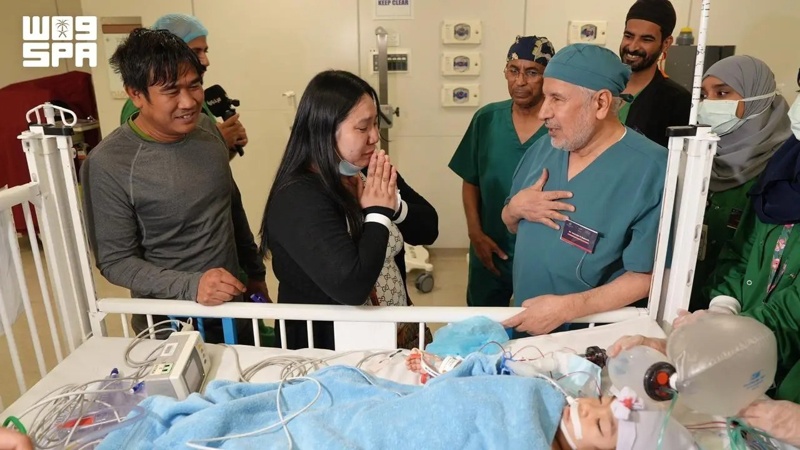 Saudi Medical Team Successfully Separates Filipino Conjoined Twins after Six-Hour Surgery