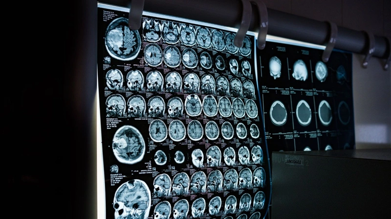Scientists, Alzheimer's, brain cells