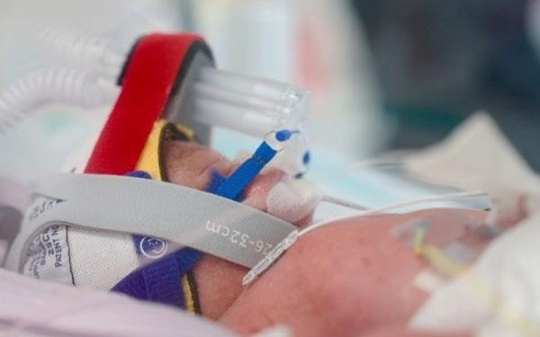 Identical quadruplet girls born in Australia