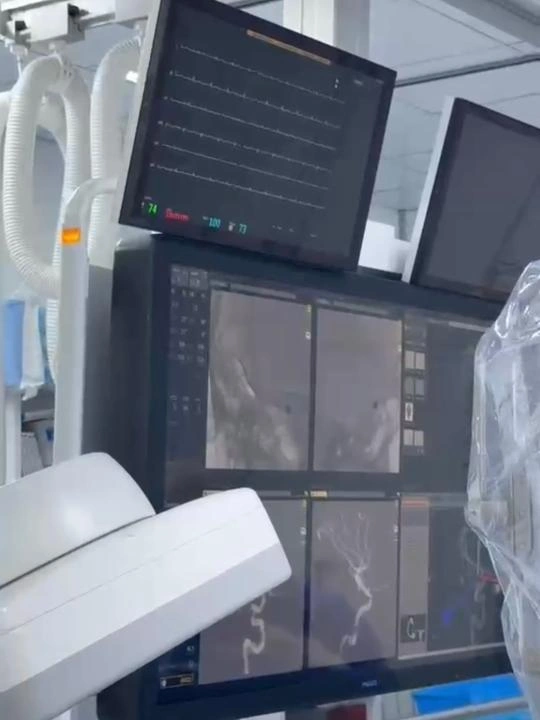 Шымкентте құны 6 млн теңгеден асатын ми операциясы тегін жасалды