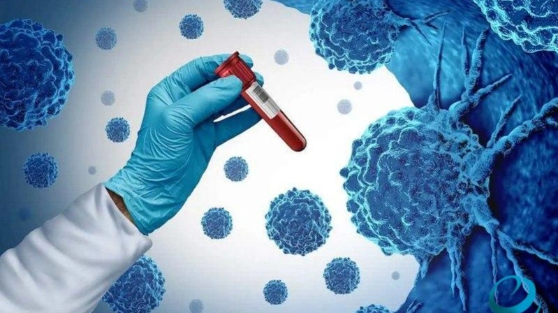 Иран ғалымдары қатерлі ісікке қарсы жаңа гель ойлап тапты