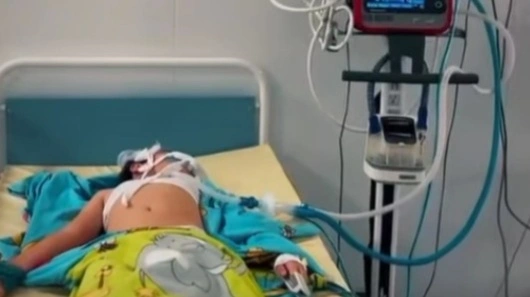 Огромный &laquo;мусорный&raquo; камень удалили из желудка ребенка в Жамбылской области