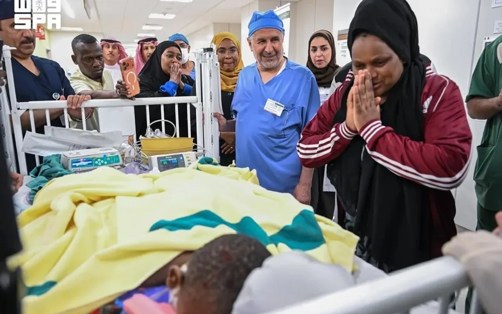 Saudi Arabian surgeons successfully separate Tanzanian conjoined twins